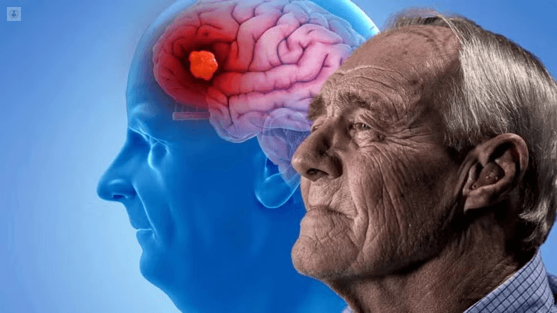 Hablemos sobre el Alzheimer